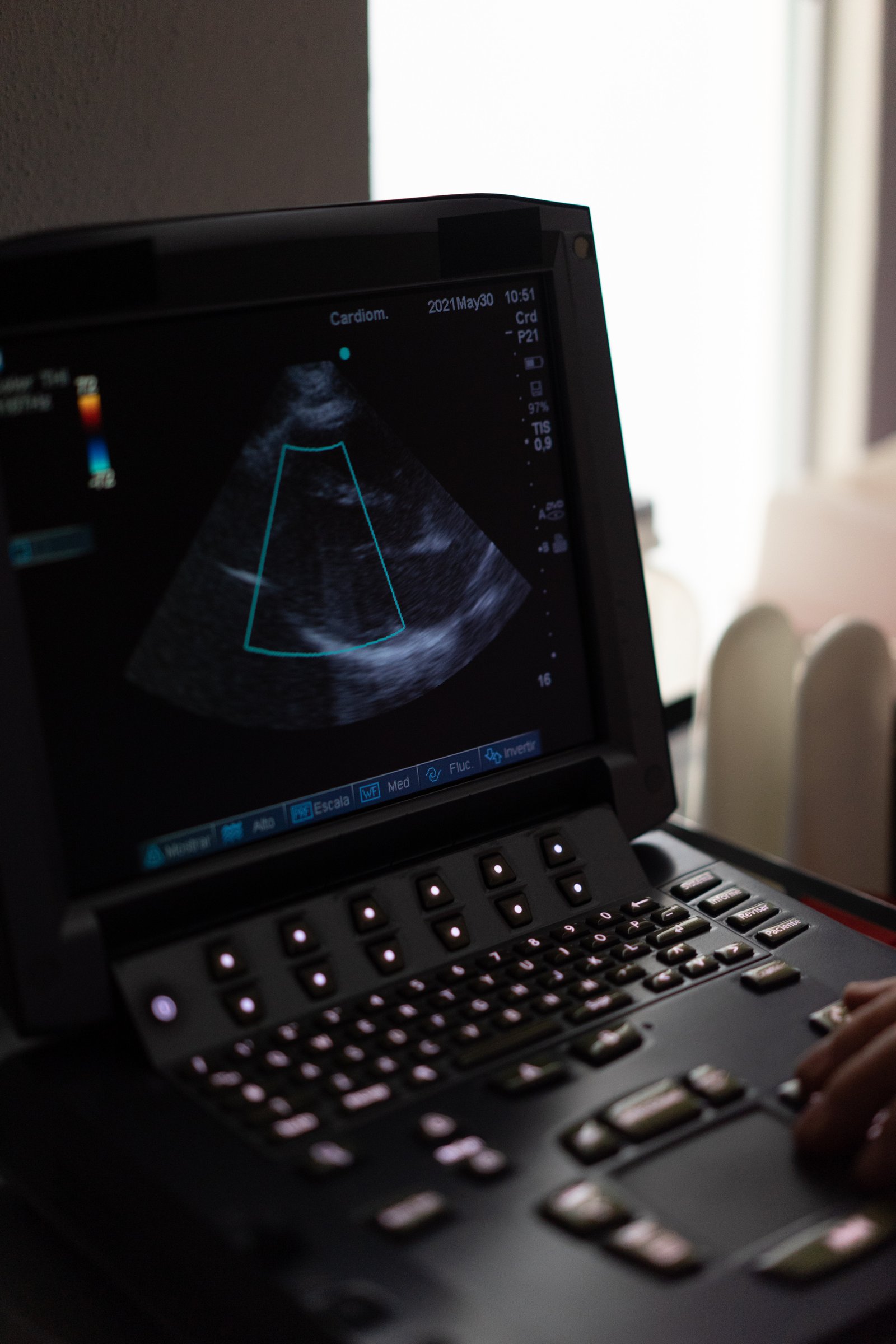 Motion sickness can be a distressing condition experienced by many individuals when traveling in vehicles or other modes of transportation. The symptoms of motion sickness, such as nausea, dizziness, and vomiting, can significantly impact the quality of life for those affected. In an effort to alleviate these symptoms, medical devices have been developed to help individuals better manage their motion sickness.